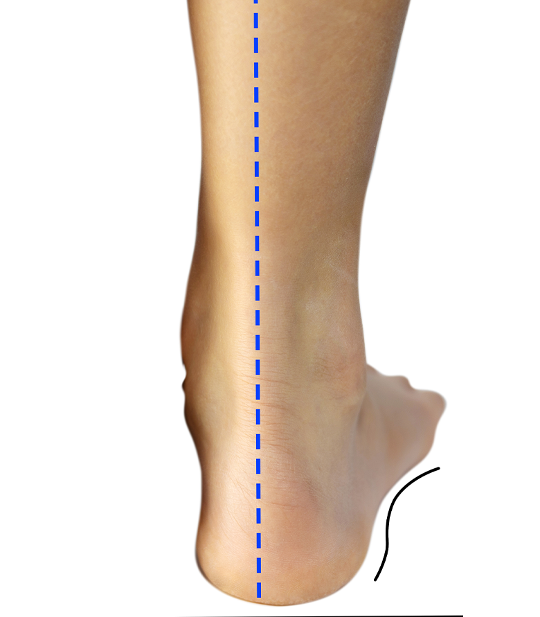 fisioterapia en orizaba